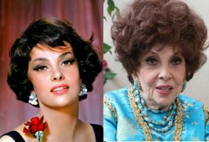 Lollo-before-after合成660